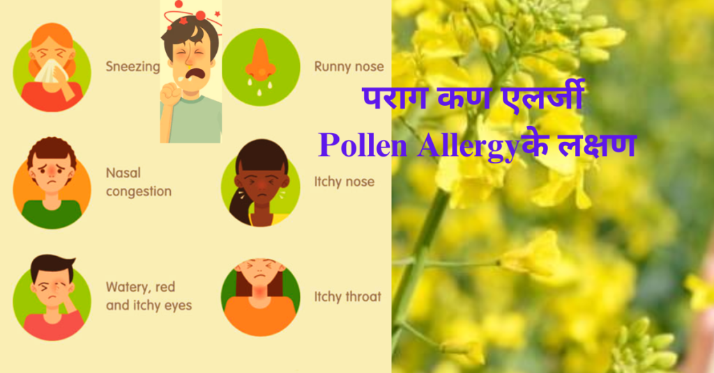 पराग कण एलर्जी Pollen Allergyके लक्षण