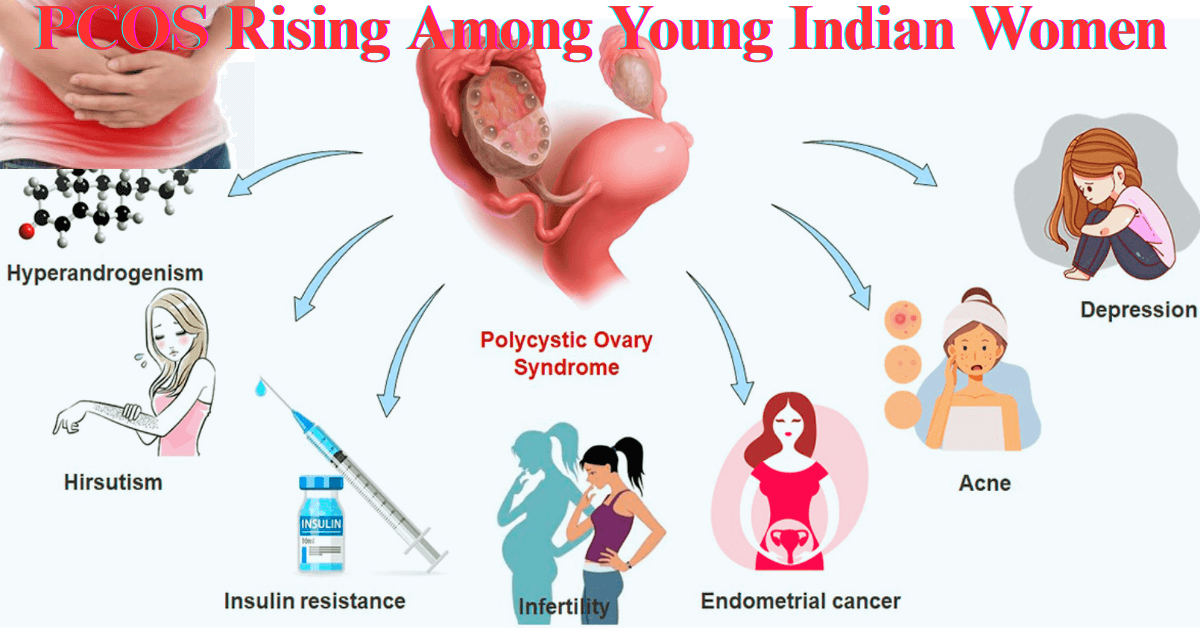 PCOS Rising Among Young Indian Women
