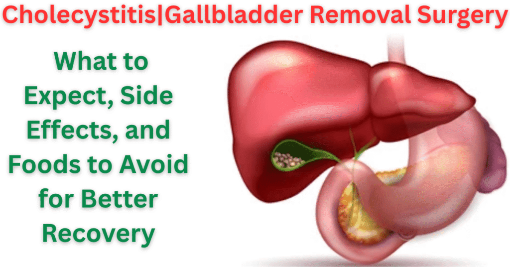 Cholecystitis|Gallbladder Removal Surgery